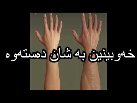 خەوبینین بە شان دەستەوە