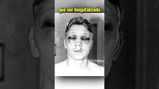 El boxeador que usó yeso en sus guantes ☠️