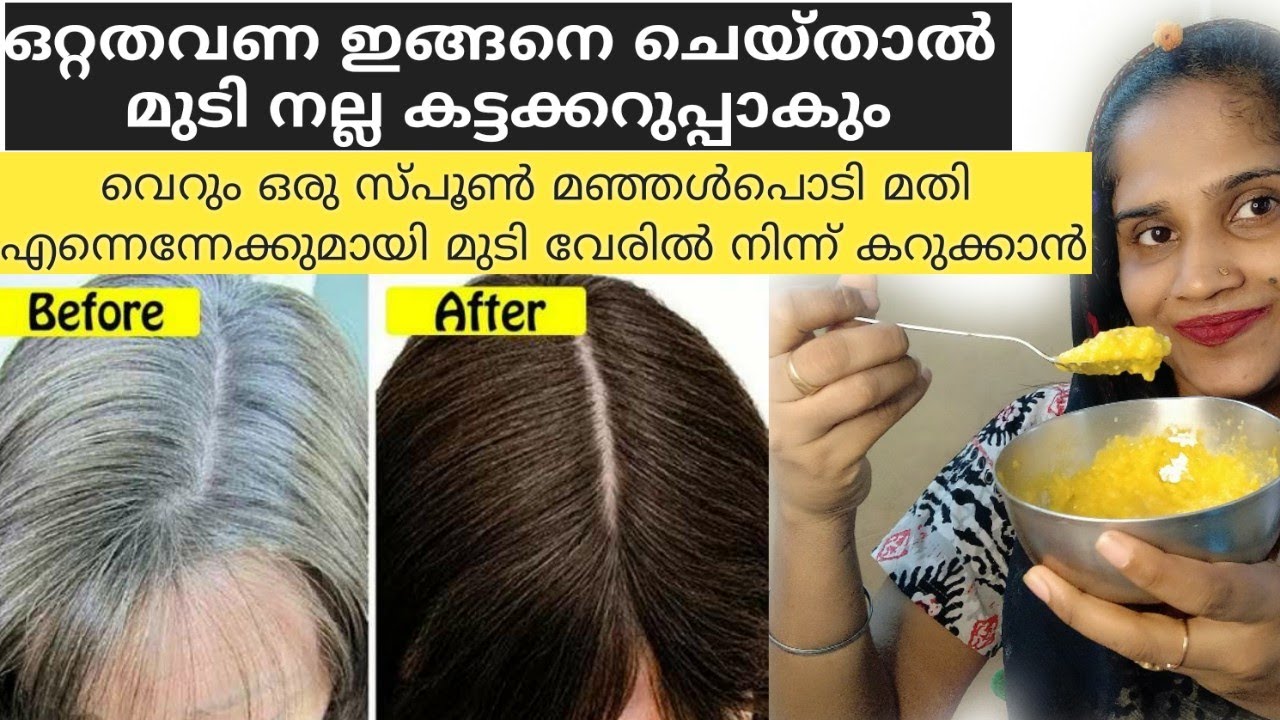 ഒറ്റത്തവണ ഇങ്ങനെ ചെയ്താൽ മതി എന്നെന്നേക്കുമായി മുടി വേരിൽ നിന്ന്