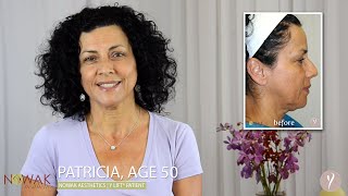 Patient Testimonial for Nowak Aesthetics | Y LIFT®