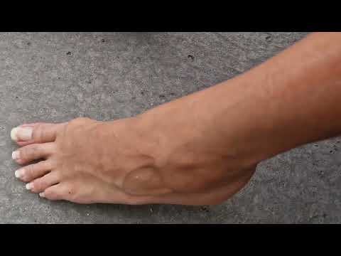 Veiny natural nails fetish