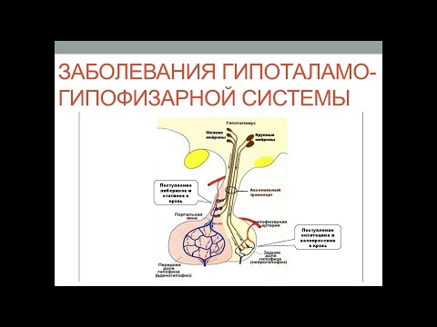 Заболевания гипоталамо-гипофизарной системы