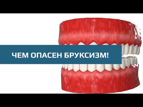 Бруксизм. Последствия бруксизма