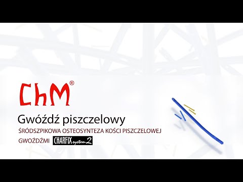 Wideo: Złamanie Kości Piszczelowej