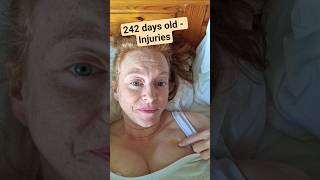 242 days old - Injuries #ivfjourney #ivf #ivfpregnancy #8montholdbaby #postnataldepression