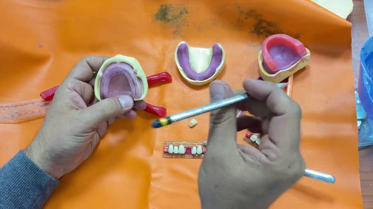 كيفية تثبيت الBite Rims على الريكورد بيس الجزء الاول