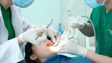 🔴[TRỰC TIẾP]: CA NHỔ 4 RĂNG KHÔN KHÓ