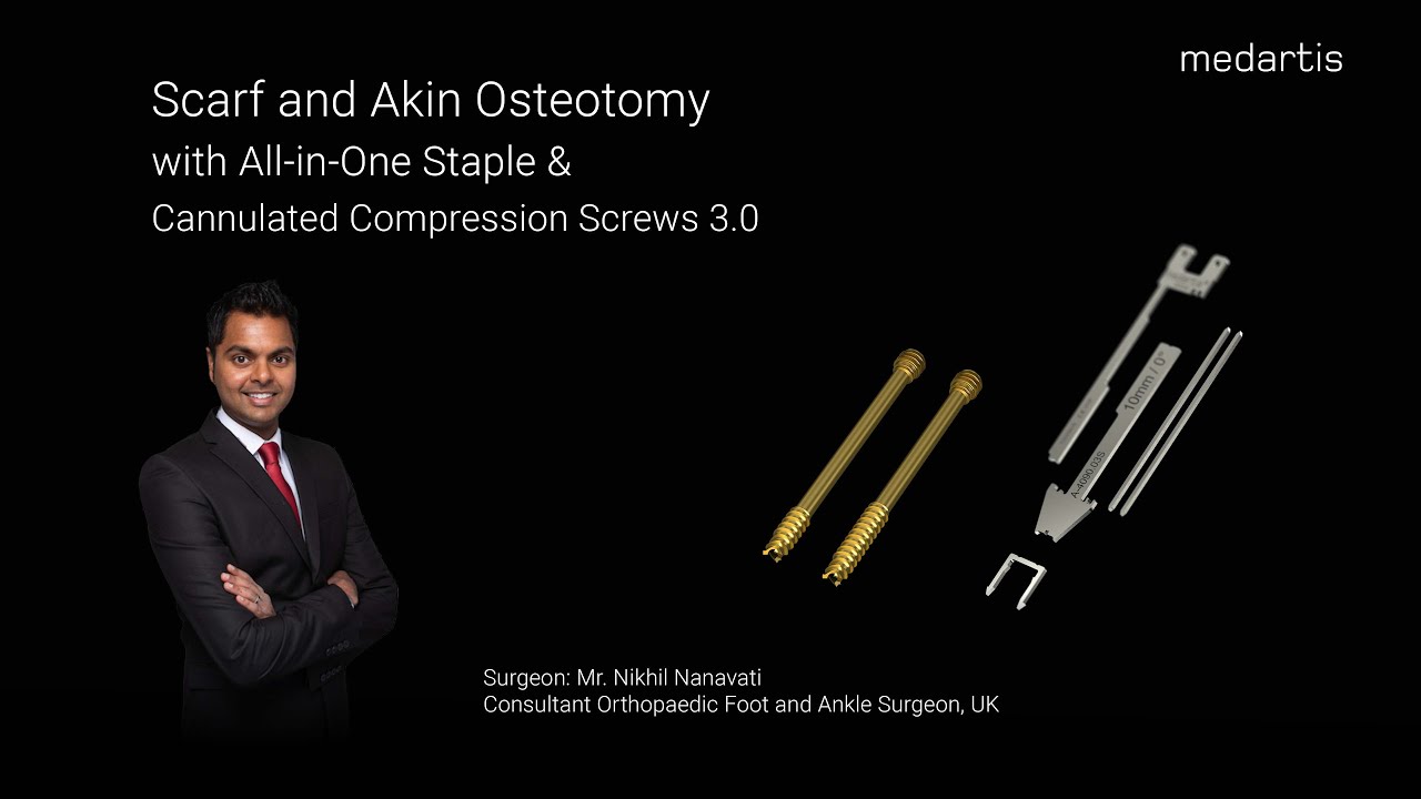 Scarf and Akin Osteotomy with CCS 3.0 and Medartis AllinOne Staple YouTube