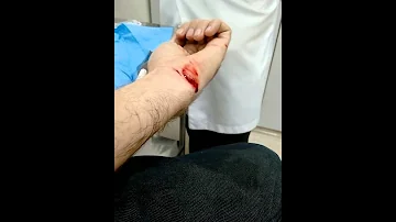 O que fazer quando se é arranhado por um gato?