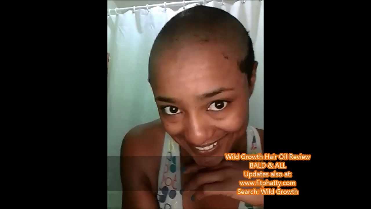 Wild Growth Hair Oil Bald To Beautiful 35 Days Day 0 Tiyona