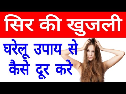 सिर की खुजली को जड़ से खत्म करने के उपाय || How to treat itchy scalp