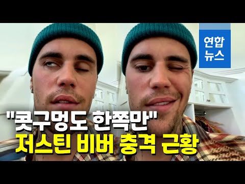 &amp;quot;내 얼굴, 반쪽만 웃네요&amp;quot;…얼굴 클로즈업 희소병 고백  / 연합뉴스 (Yonhapnews)