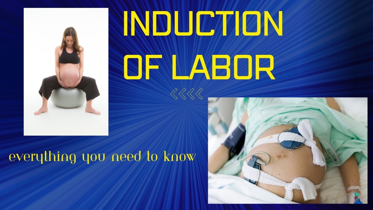 induction of Labour everything you need to know YouTube