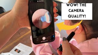 Curious What the inside of your ear looks like? BEBIRD R1 Wax Removal Tool for Ears