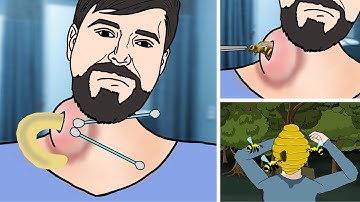 [ASMR ANIMATION] Remove bee🐝 in MrBeast