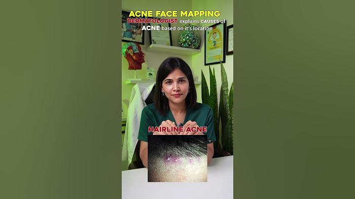 Let's find out the cause of your acne ❗