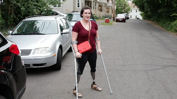 Clara Gardner Walking with Osseointegration...  Po...