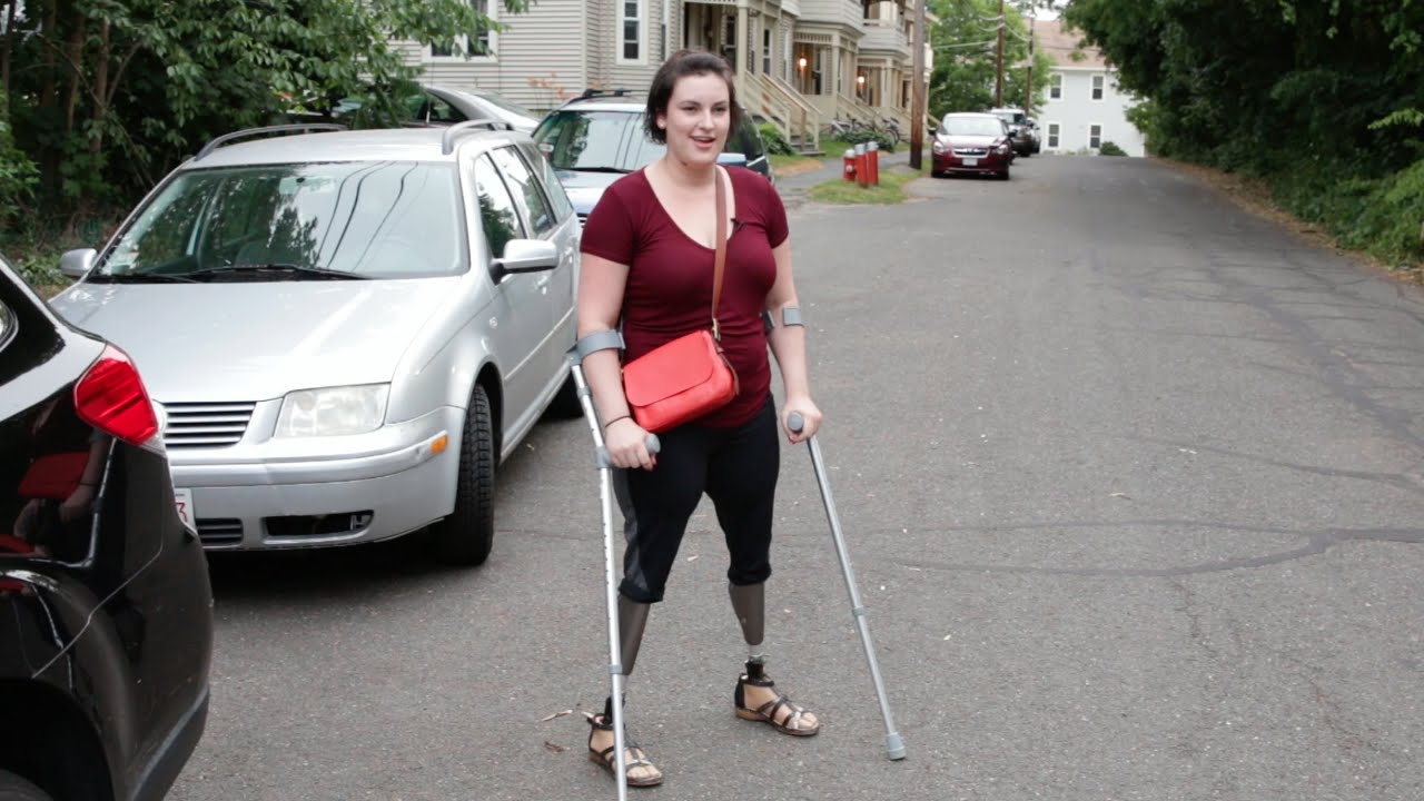 Double Above Knee Amputee Double Above Knee Amputee