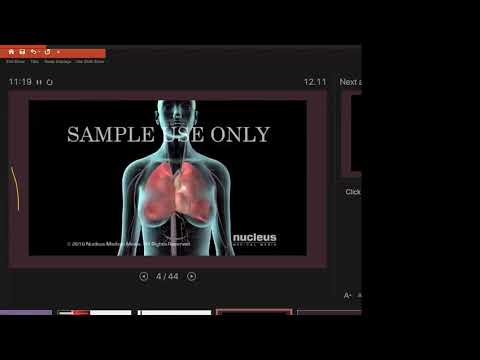 Emboli Pulmonal