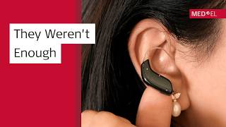 Why Hearing Aids Weren’t Enough | Cochlear Implant Story (Ep. 2)