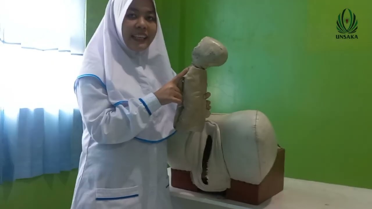 Mekanisme Persalinan Sungsang dan Teknik–Teknik Pertolongan Persalinan Sungsang