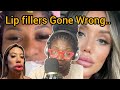 WOMAN CRIES out as her lip fillers goes wrong on doctor's Watch...