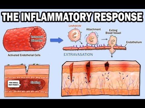 Thumbnail for the embedded element "THE INFLAMMATORY RESPONSE"