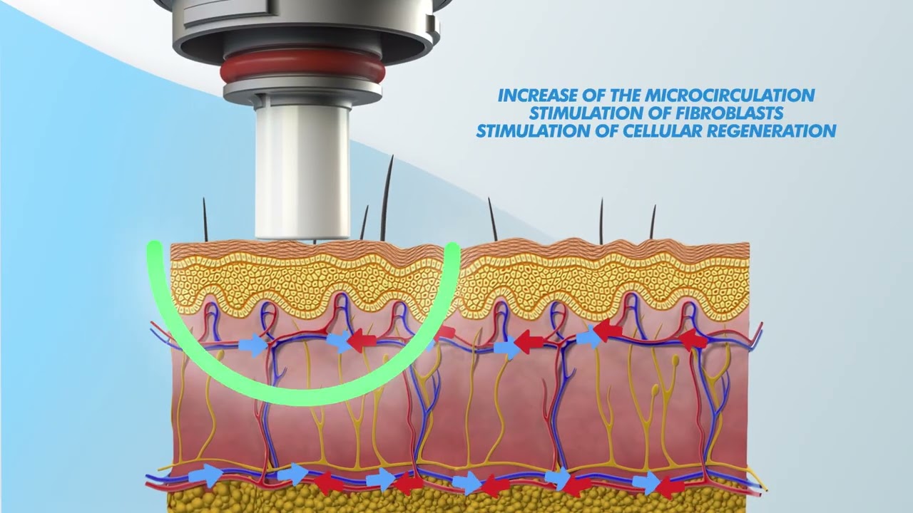 Tricopat Hair Loss Treatment