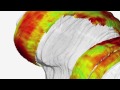 MQIR and Noninvasive Assessment of Knee Cartilage Health