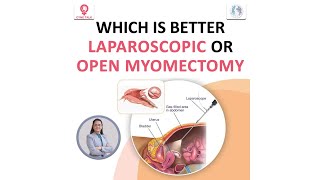 Which is better: Laparoscopic Myomectomy or Open Myomectomy - Dr. Amita Shah