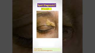Dermatology Spot Diagnosis Quiz #31. Doctors, check your Clinical Skill