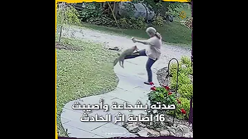 ركلته بشجاعة ثعلب مسعور يهاجم امرأة ستينية بلا هوادة في حديقة منزلها 