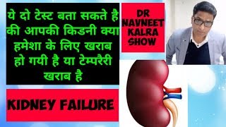 Kidney Failure.य द टसट बत दग क आपक कडन हमश क लए खरब ह गय ह य टमपरर खरब ह