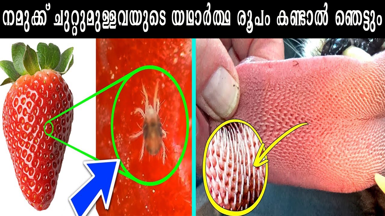 ഈ കാര്യങ്ങൾ മൈക്രോസ്കോപ്പിൽ കാണാൻ നിങ്ങൾ ആഗ്രഹിക്കില്ല| ഇനി പൂച്ച കാലിൽ നക്കുമ്പോൾ ഇതോർത്തോളൂ