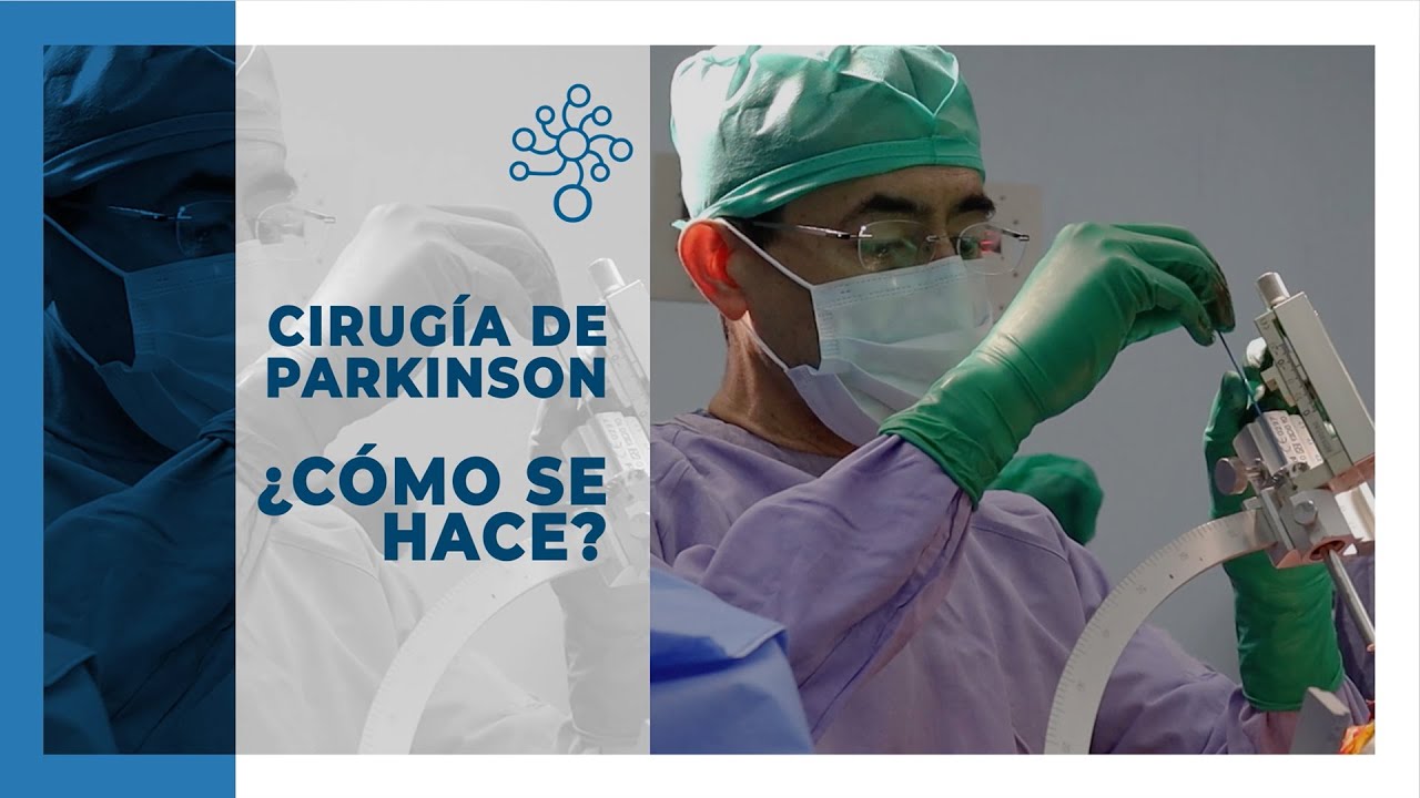 ¿Cómo se hace la cirugía de Parkinson?