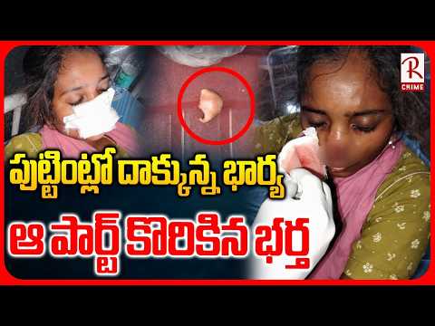 పుట్టింట్లో దాక్కున్న భార్య.. ఆ పార్ట్ కొరికిన భర్త | Husband Bites Wife's Nose Incident | RTV Crime