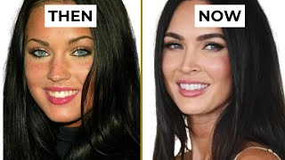 MEGAN FOX Smile Transformation