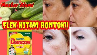 Flek Hitam Rontok‼️Masker Timun Dan Susu Dancow Menghilangkan Kerutan Dan Flek Hitam || Masker Alami