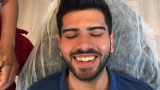 Yanliş Erkek Kaş Alimi