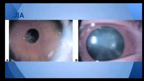 Clinical Pearls- Ophtalmology- Dr. Linda Lehman, 4...