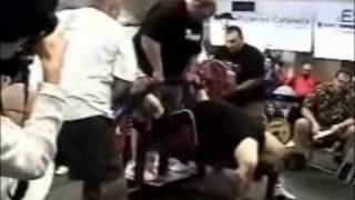 Bench Press Accident