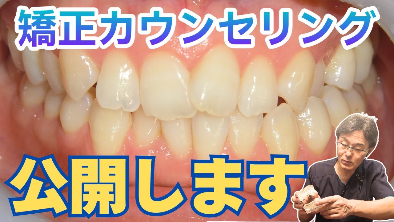 カウンセリング公開】当院のカウンセリングの様子を紹介しています