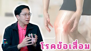 โรคข้อเสื่อ EP153/3 | นายแพทย์ธีรวีร์ วีรวรรณ