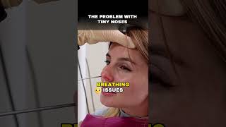 The Problem with Barbie Nose #plasticsurgery #plasticsurgeryrevision #barbienose #smallnose