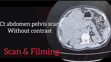 How we can perform  scan abdomen pelvis without contrast and filming .
