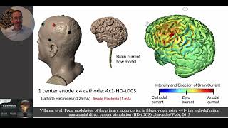Optimizing brain targeting with HD-tDCS (how to design tDCS montages for targeted outcomes)