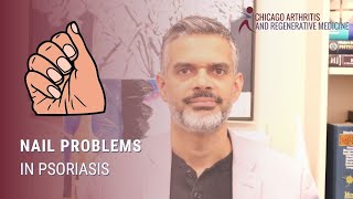 Nail Problems in Psoriasis Nail Problems in Psoriasis