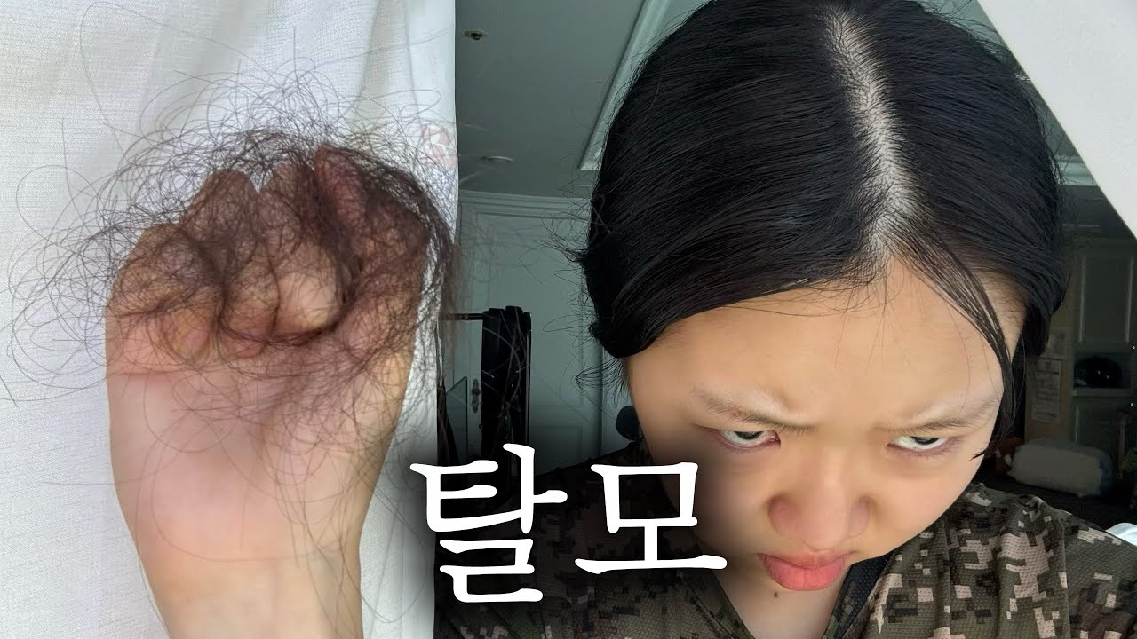 기어코 22살에 탈모가 와버린 간호학과 브이로그