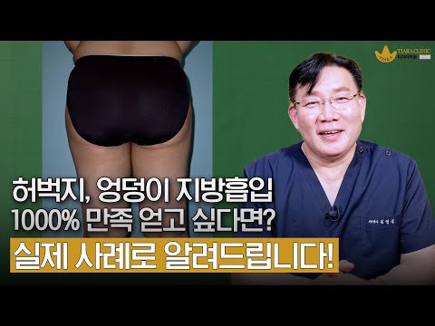 연예인이 허벅지 지방흡입하는 이유