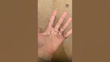 Ternyata Ini Alasan Kenapa Rambut Sering Rontok😱